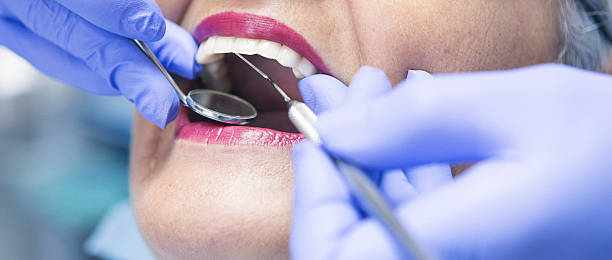 Best Emergency Care for Gum Disease in Roselle, IL